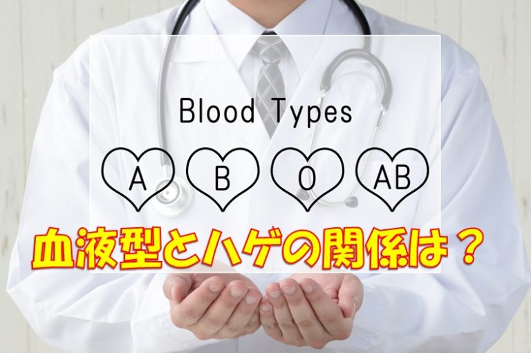 血液型とハゲ Aga は関係するのか 血液型の歴史的事実 ルーツ を踏まえて 徹底検証